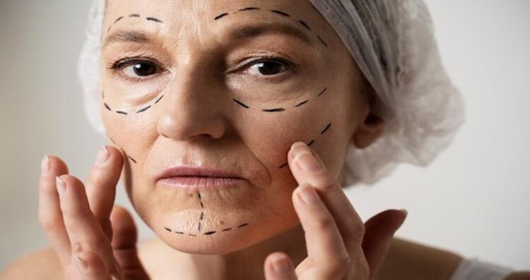 Facelifts For The Modern Individual: Balancing Aesthetics And Emotional Health